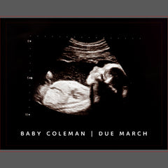 Pregnancy Announcement Sonogram Coming Soon Jigsaw Puzzle