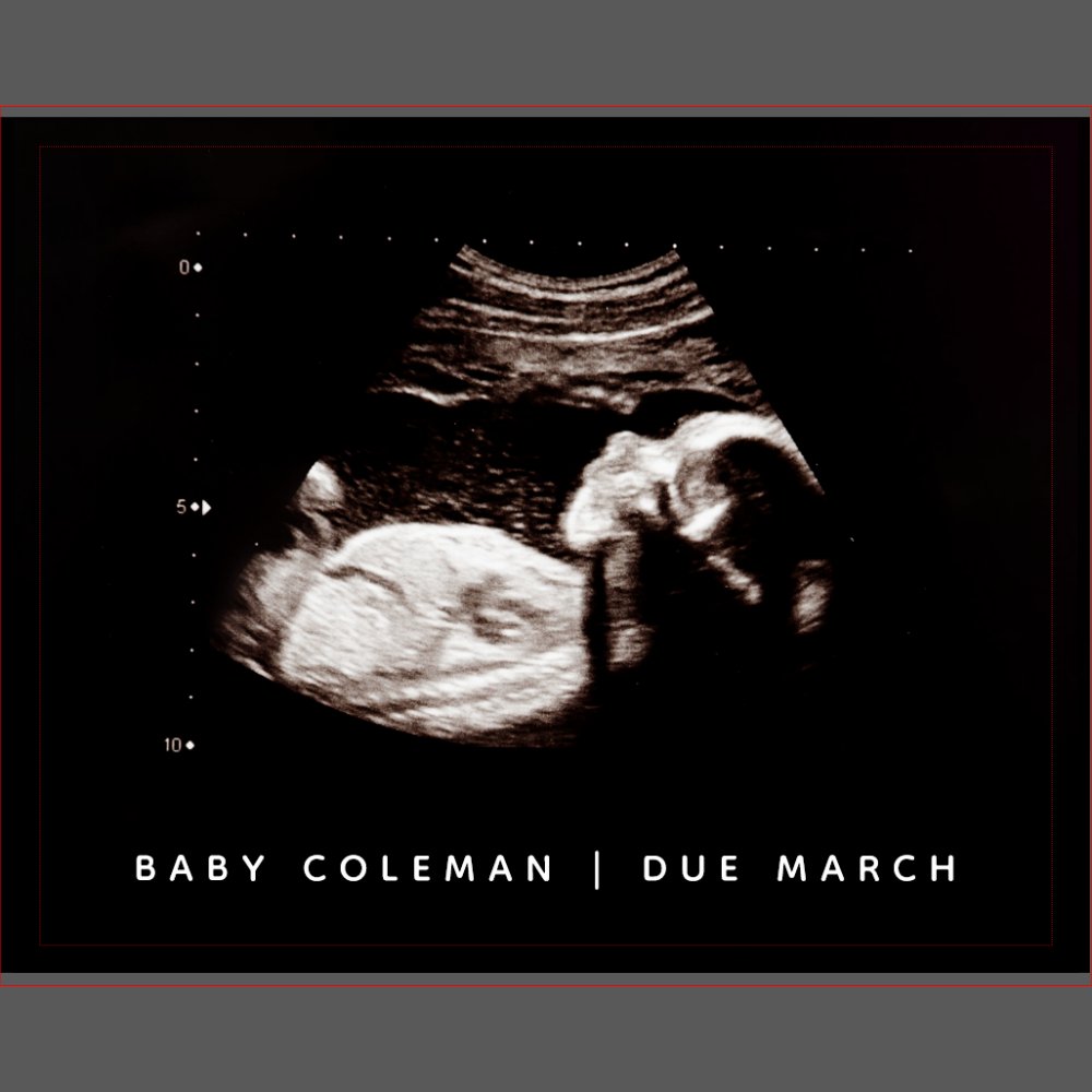 Pregnancy Announcement Sonogram Coming Soon Jigsaw Puzzle